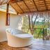 Otros